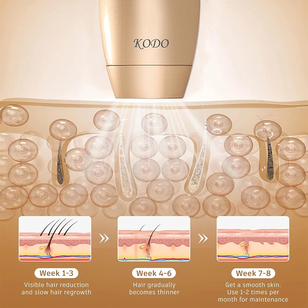 KODO 2024 High-end customization ice Laser Hair removal